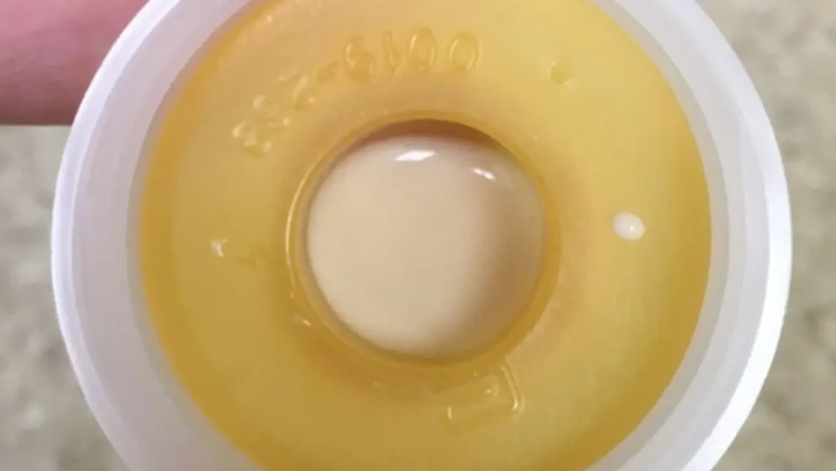 Expressing Colostrum for LTP/ET/SGA Babies